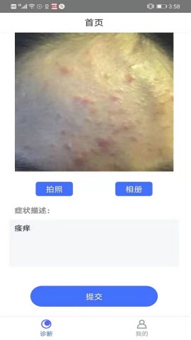 皮肤病在线拍照自测appv104安卓版